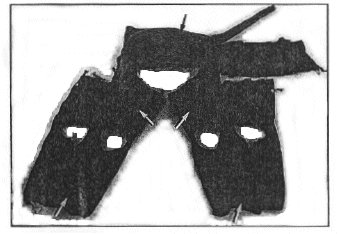  Figure 2. Inflated anti-G suit. The distensible bladders are indicated by the arrows.